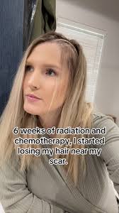 Glioblastoma Recovery