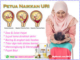 Posisi bayi sungsang di dalam kandungan adalah salah satu kelainan posisi bayi yang termasuk abnormal. Mymuroh Com