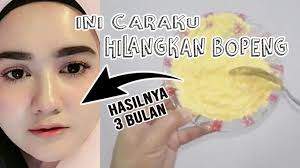 New Video By Slowmom On Youtube Jerawat Makanan