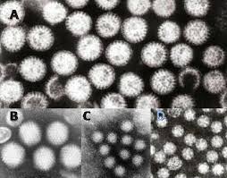 Gastroenterit Vikipedi