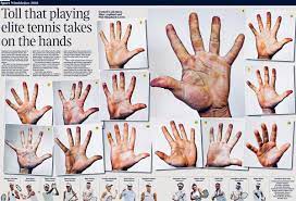 This means that my skin can start to split on. Stuart Fraser On Twitter In Today S Times The Racket Holding Hands Of 13 Tennis Players Can You Identify Roger Federer And Simona Halep Rafael Nadal Not So Hard Https T Co Yqmeudj9go Wimbledon Https T Co Vondoj2vgc
