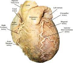 The tibial peroneal trunk was diffusely diseased with sequential 95 percent stenosis present. Figure 3 The Clinical Anatomy Of The Coronary Arteries Springerlink