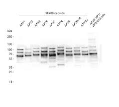 Image result for White 1997 AAV