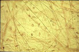 Loose Fibrous Connective Tissue Areolar Tissue Medical Laboratory Science Medical Laboratory Human Anatomy And Physiology