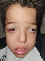 Hope for Kevin's Heart