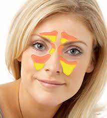 Namun, bukan berarti hubungan menjadi berakhir saat mengetahui kalau wanita yang kita idamkan ternyata sudah tidak perawan. Sinusitis Akut Gejala Rawatan Resdung Akut