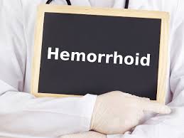 Neben den schmerzen sind afterjucken und blut im stuhl typische symptome für hämorrhoiden. Hamorrhoiden Symptome Behandlung