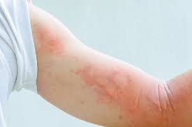 We did not find results for: Six Possible Side Effects Of Vitamin B Overdose Medicover Hospitals