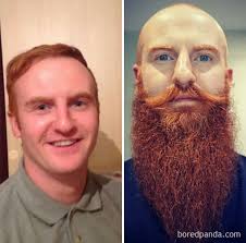 The nfl has an actual rule where players are allowed to be tackled by any excess hair hanging out of their helmet, like fellow steeler troy polamolu did on this likely touchdown run. 30 Before After Pics That Will Make You Reconsider Shaving Your Beard Bored Panda