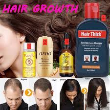 To use rosemary oil for hair loss, add several drops of the essential oil to hair care products for an. Hair Loss Treatment Make Your Hiar Thicker Hiar Growth Shampoo Hair Growth Essence Hair Growth Essential Oil Hair Growth Ginger Essential Oil Hair Care Wish