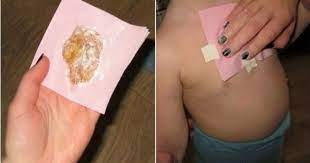 Batuk kering merupakan jenis batuk yang tidak diikuti dengan munculnya dahak atau lendir. Tak Perlu Obat Begini Cara Menghilangkan Dahak Dengan Bahan Alami Semua Halaman Grid Health