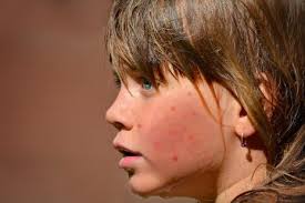 وربما يدل تفسير حلم ازالة شعر الجسم للعزباء علي تخلصها من الهموم والمشاكل. ØªÙØ³ÙŠØ± Ø­Ù„Ù… Ø±Ø¤ÙŠØ© Ø­Ø¨ Ø§Ù„Ø´Ø¨Ø§Ø¨ ÙÙŠ Ø§Ù„Ù…Ù†Ø§Ù… Ø±Ù…Ø² Ø­Ø¨ Ø§Ù„Ø´Ø¨Ø§Ø¨ ÙÙ‰ Ø§Ù„Ø­Ù„Ù…