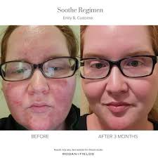 Judy Mathias: R+F Independent Consultant