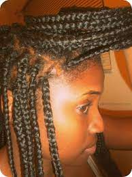 5 Tips To Relieve A Dry Itchy Or Irritated Scalp From Box Braids A Desired Beauty Scalp Braids Dry Scalp Treatment Dry Itchy Scalp
