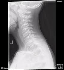 They show pictures of your internal tissues, bones, and organs. Head And Neck Undergraduate Diagnostic Imaging Fundamentals