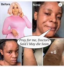 PHOTONEWS : Tears As Nollywood Actress, Aunty Ramota Reportedly In Coma  After Undergoing A Failed Yansh Surgery 😭😭😭😭