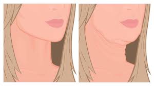 … continue reading the best ways to get rid of sagging jowls Dermatologists Explain How To Prevent Sagging Jowls