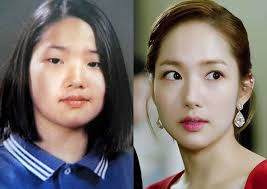 8 artis korea yang cantik alami tanpa operasi plastik. 5 Artis Korea Ini Jujur Pernah Operasi Plastik Ini Fotonya Kincir Com