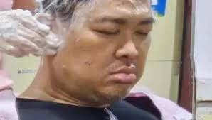 Usai Periksa Ginjal, Ini Aktivitas Kesaharian Alvin Lim di China