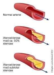 Med figurer, bilder og gjennom samtaler med. Tett Pulsare I Benet Akutt Nhi No