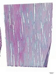 Image result for Dalbergia boehmii