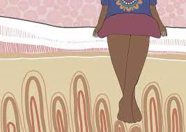 Cervical cancer is most commonly diagnosed in women over 30, but it can occur at any age. Sistas Get Checked Cancer Council Victoria