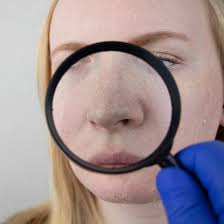 Close encounter of the toothsome kind