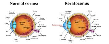 Image result for Cornea
