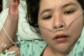 Fundraiser for Lisette Loza by Reina Ramos : Help Lisette recover from  Flesh-Eating Infection