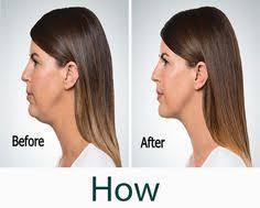 Image of facial exercises for reducing double cheeks