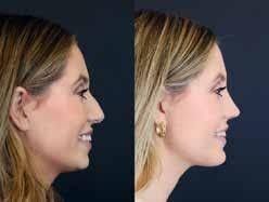 Mckayla Abbott's Instagram, Twitter & Facebook