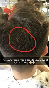 He Pulled His Hair Out Charles Meme James Charles Charles James
