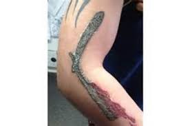 A scab is the protective tissue covering that forms after your skin has been damaged by a cut or abrasion. How To Deal With Scabbing On Your Tattoo Tatring
