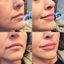 Breana May, FNP-C (@bre_740aesthetics) · Instagram photos and videos