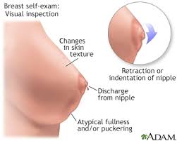 Fenugreek leaves and seeds are commonly consumed as lactogenic food in several cultures (7). Premenstrual Breast Changes Information Mount Sinai New York