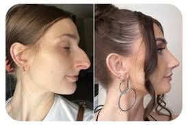 Align ENT + Allergy Announces Partnership with Philadelphia, PA Facial  Plastics Surgeon, Timothy Greco, MD