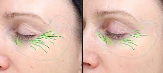 How does fish oil really help in hair growth? Will Rubbing Fish Oil On Your Face Banish Wrinkles Or Just Leave You Whiffy Daily Mail Online