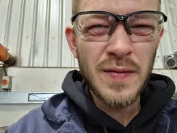 Welding with bifocal safety glasses