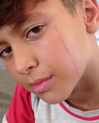 Campanha de arrecadação de fundos de Emily Pinson: Help Rozan and Her  Family in Gaza