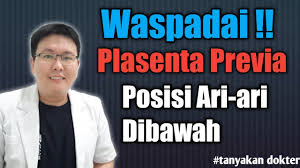 Rsu ari canti updated their cover photo. Plasenta Previa Letak Ari Ari Dibawah Tanyakan Dokter Youtube
