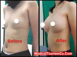 Pin On Affordable Plastic Surgery