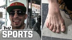 Boxer Danny Garcia -- I'VE GOT 6 TOES ... This Little Piggy Gives Me a Huge  Advantage!