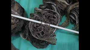 Jan 25, 2017 · when i made my mod mesh honey crocheted blanket sweater, i wanted to use a very easy mesh pattern. How To Knit A Ruffle Scarf Tutorial Mesh Sashay Scarf Youtube