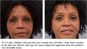 Image result for Blepharis transvaalensis