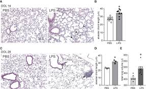 Please let me inform through direct message. Frontiers Ccr2 Mediates Chronic Lps Induced Pulmonary Inflammation And Hypoalveolarization In A Murine Model Of Bronchopulmonary Dysplasia Immunology