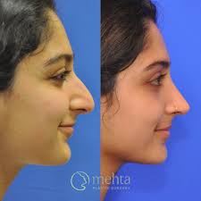 Mehta Plastic Surgery added a new...