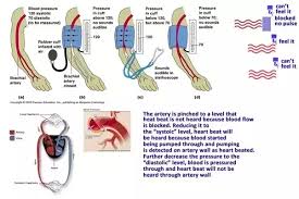 Hi i'm 17 female and tomorrow i'm getting my blood drawn for testing and i have really bad anxiety and i'm so scared does it hurt like a shot because i'm fine with shots there quick and easy any tips you guys could give. Is It Normal For Your Arm To Go Numb While Taking Blood Pressure Quora