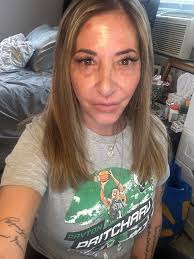 Monday blues and alternative treatments for aches and pains