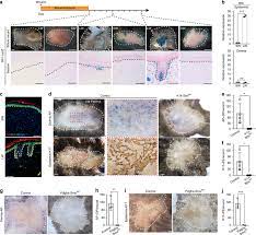 Microneedling works by stimulation of stem cells and inducing activation of growth factors. Hedgehog Stimulates Hair Follicle Neogenesis By Creating Inductive Dermis During Murine Skin Wound Healing Nature Communications