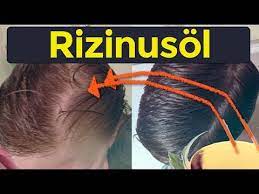 Um zu wissen, wie man rizinusöl verwendet, um falten zu entfernen, lese weiter. Wie Man Kahlheit Mit Rizinusol Verhindert Stoppt Haarausfall Mit Rizinusol Youtube